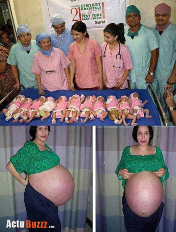 Une femme enceinte de 11 petit bebes 
