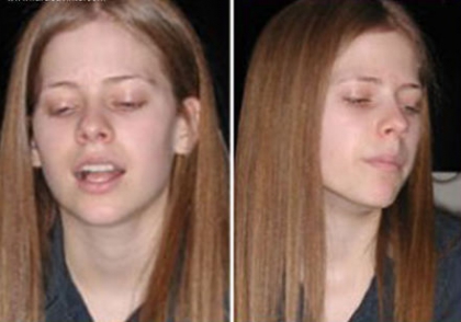 AVRIL LAVINGE sans maquillage.