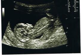 voila mes échographie! - photo 2