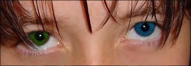 (heterochromia iridis) 