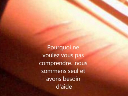 Je souffre :$ - photo 2