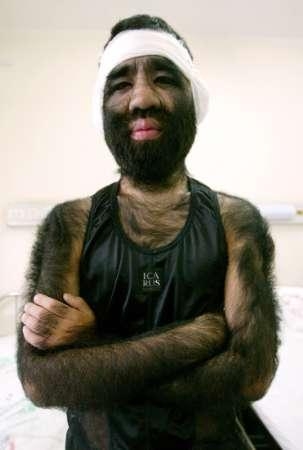 lhomme le plus poilu