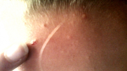 mes boutons - photo 2