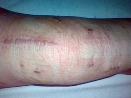 mon talent  (pour les chutes) - photo 2