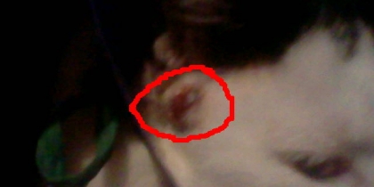 le pere des chaton et bl�sser - photo 2