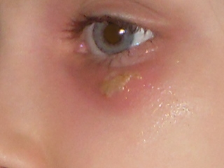 regarder jai une alergie 