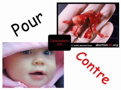 Tu es plutot pour ou contre l'avortement ?