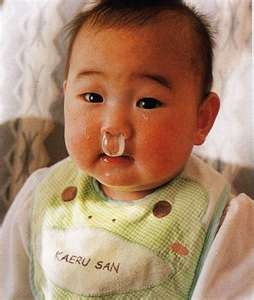 bebe avec crotte de nez