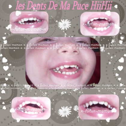 Ses belle dents 